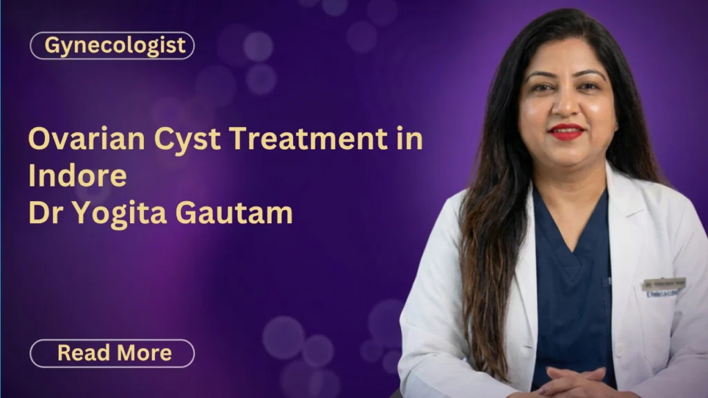 Ovarian Cyst Treatment in Indore