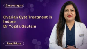 Ovarian Cyst Treatment in Indore