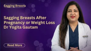 Sagging Breasts After Pregnancy or Weight Loss