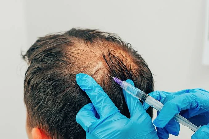 Modern Hair Regrowth Treatments That Actually Work